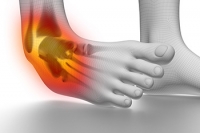 Ankle Sprain Causes and Potential Treatments