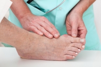 How Do I Know If I Have a Bunion?